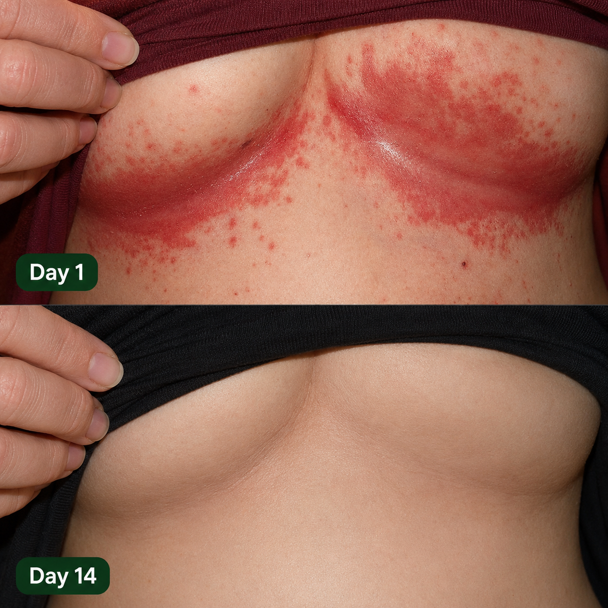 Ambero Antifungal Barrier Cream